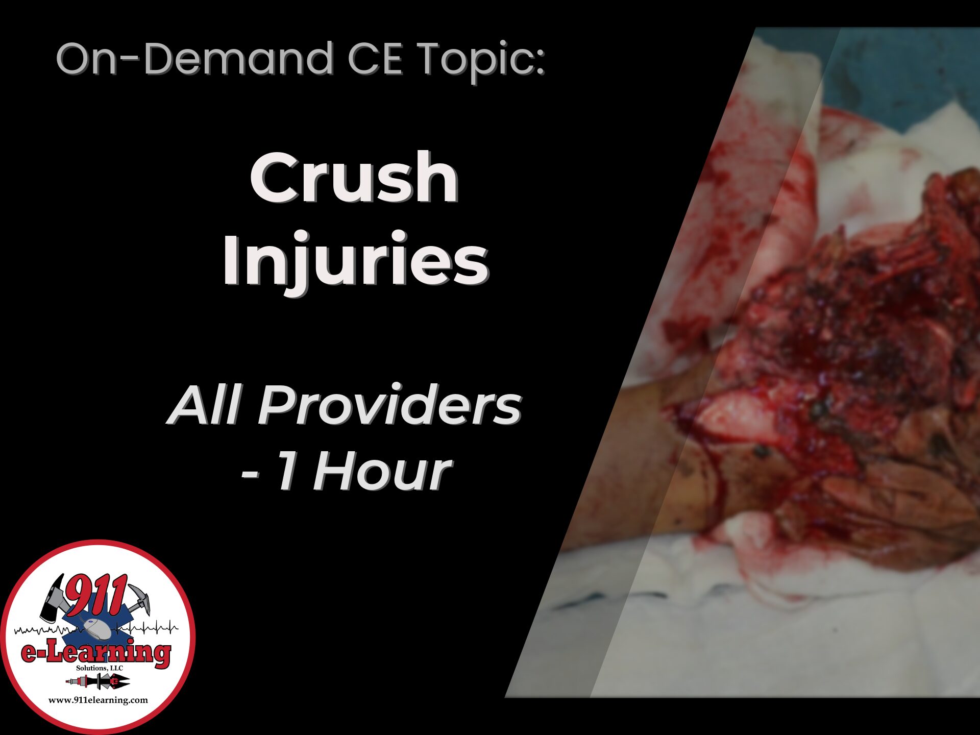 Crush Injuries - All Providers | 911 e-Learning Solutions, LLC